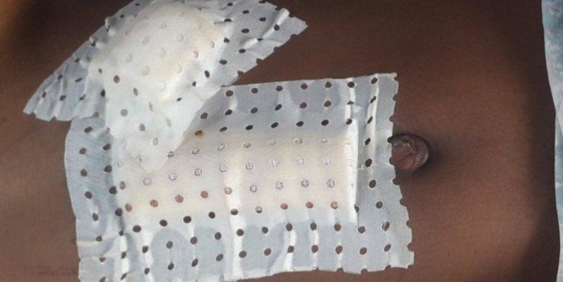 Une vue des blessures de la jeune fille. (DR)