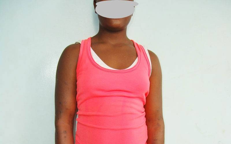 Une adolescente victime d'abus sexuel. (DR) 