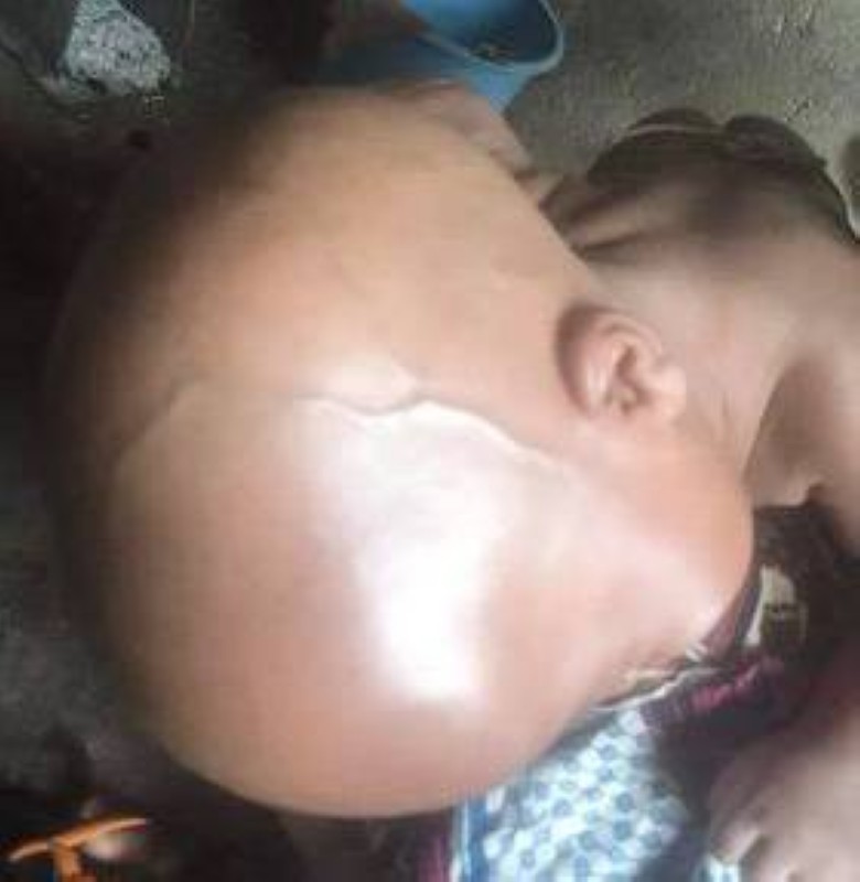 La tête du nourrisson ne cesse de grossir. (Ph: Konan Yannick)
