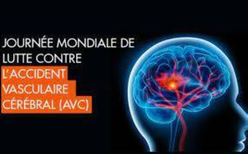 AVC. PH: DR