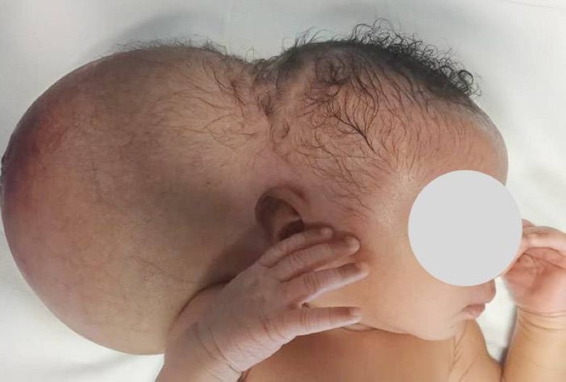 La famille du nouveau-né plaide auprès des volontés pour l'aider à opérer le bébé.