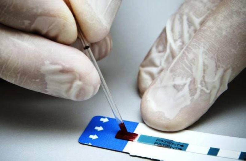 La lutte contre le Vih/Sida continue de plus belle. (Ph: Dr)