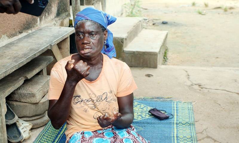 La lèpre continue de gâcher des vies en Côte d’Ivoire. (Ph: Véronique Dadié)
