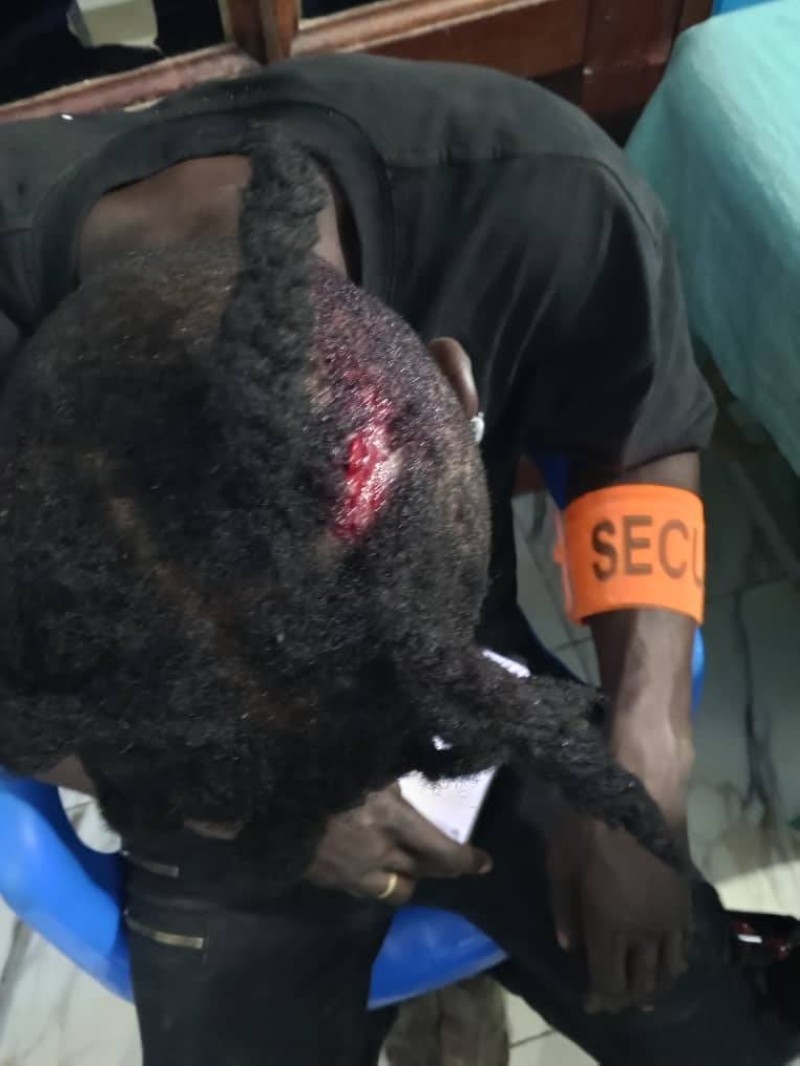 L'un des vigiles agressés par des bandits (DR)