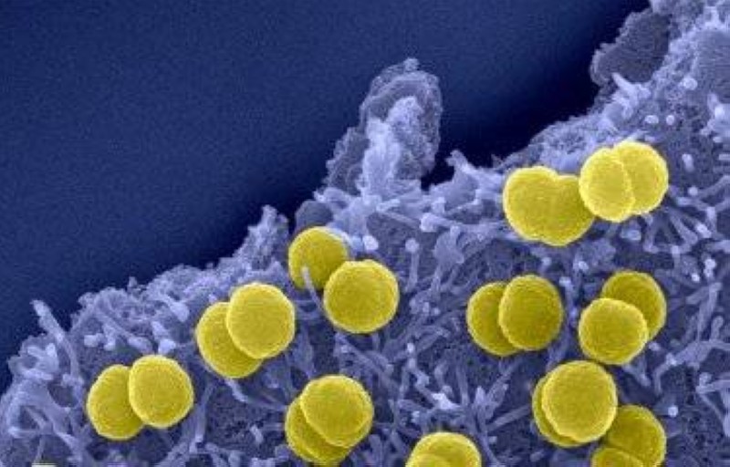 Microbes responsables des meningites. (Ph:Institut Pasteur)
