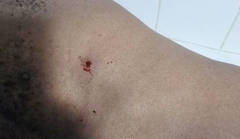 Des individus armés ont ouvert le feu, lundi 19 mai 2025, aux environs de 9h, sur des sociétaires de la MATCA, faisant plusieurs blessés par balle. (Ph: Dr)