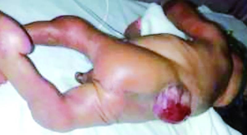 La cigarette expose l'enfant à des pathologies notamment des malformations. (Ph: Dr)
